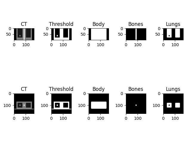 CT, Threshold, Body, Bones, Lungs, CT, Threshold, Body, Bones, Lungs