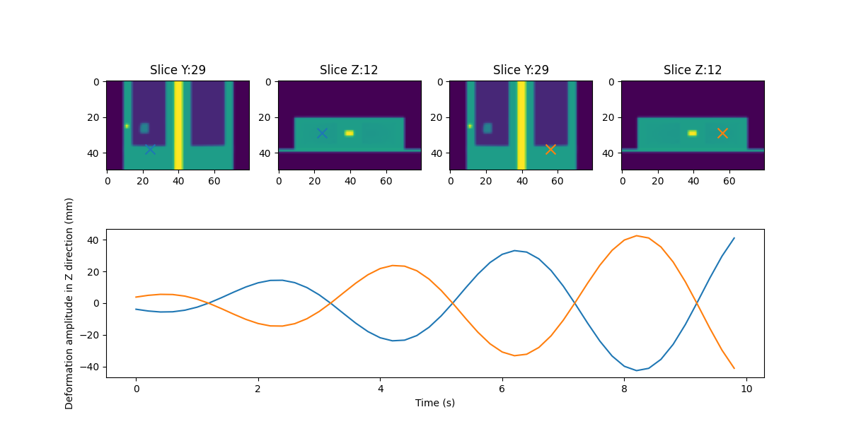 Slice Y:29, Slice Z:12, Slice Y:29, Slice Z:12