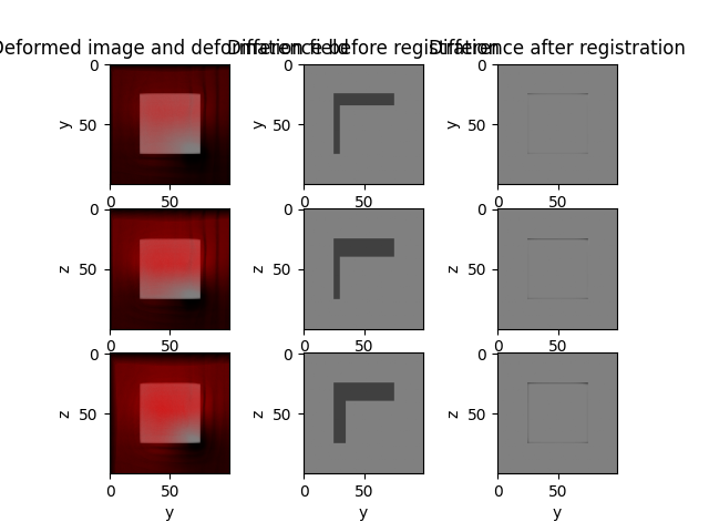 Deformed image and deformation field, Difference before registration, Difference after registration